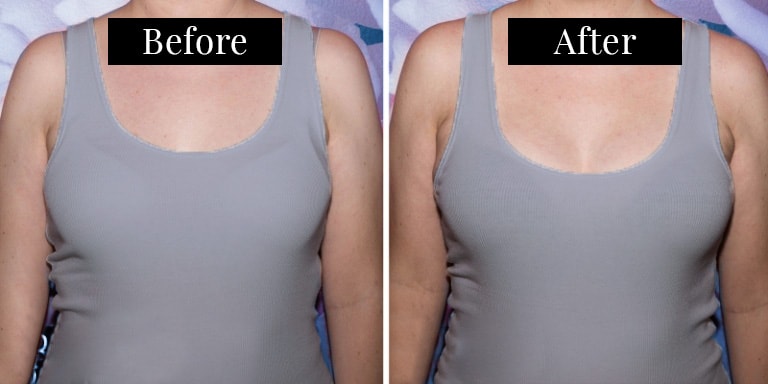 Before and after of a woman wearing a Victoria's Secret Bombshell Bra in a 34B